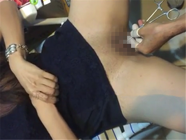 穿阴环,特写全过程