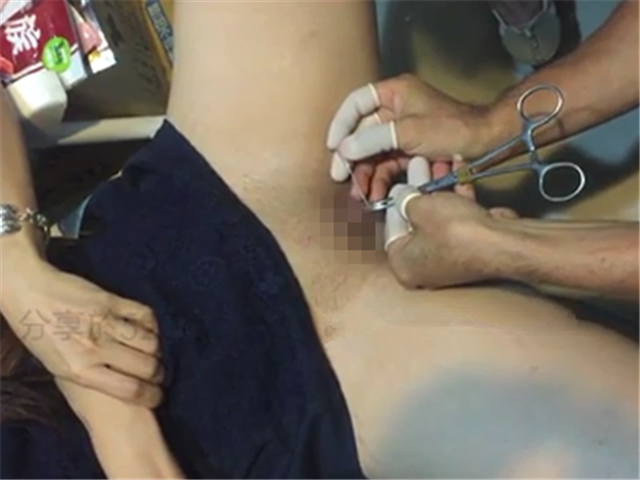 穿阴环,特写全过程